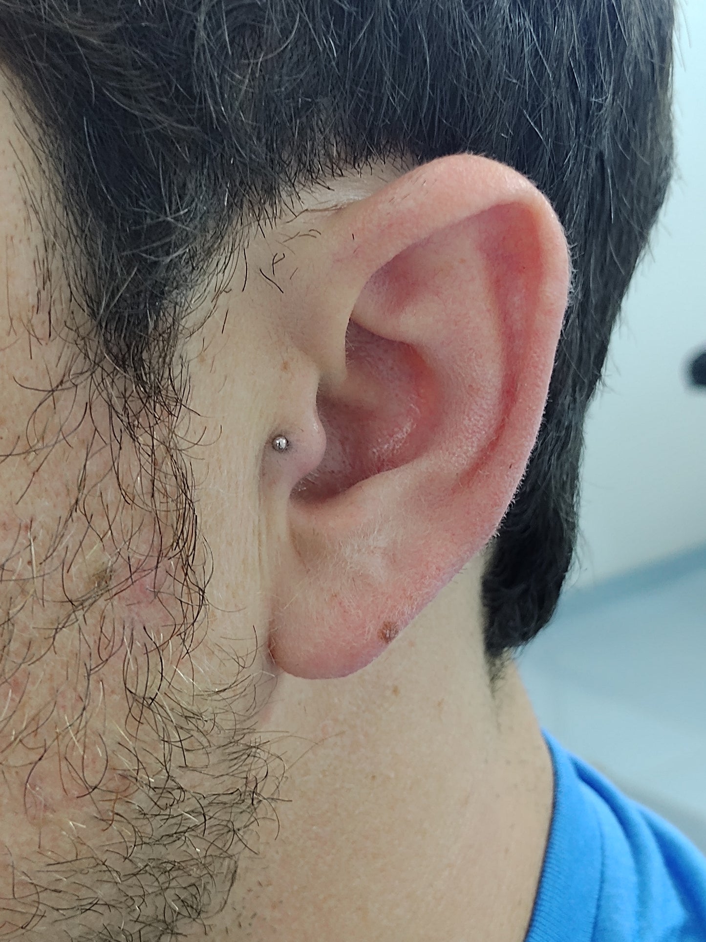 Titanio grado implante. Labret clásico