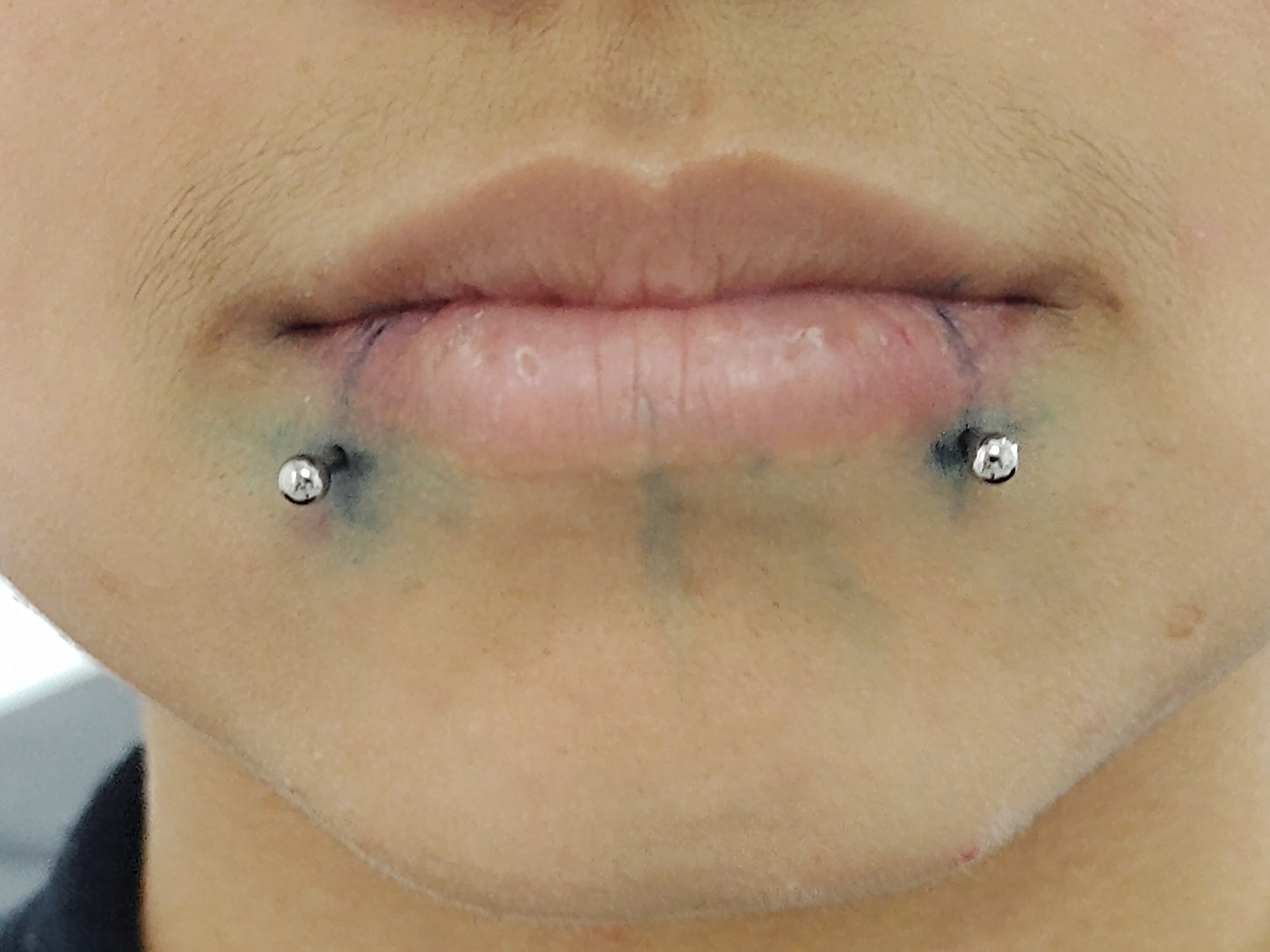 Titanio grado implante. Labret clásico