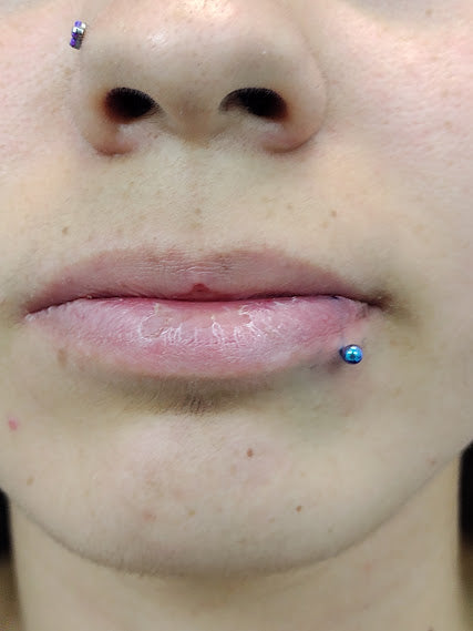 Titanio grado implante. Labret clásico